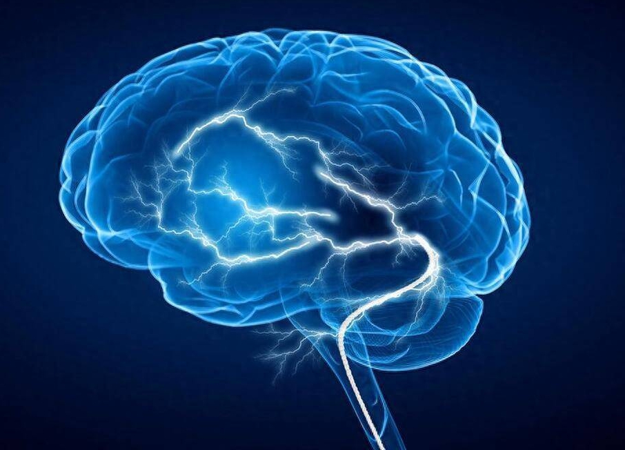 針對腦卒中工程化改造外泌體